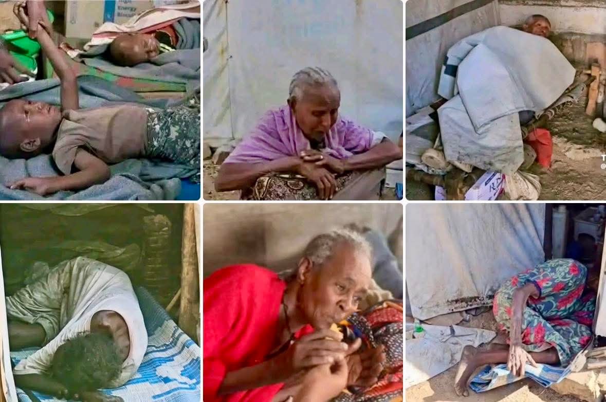 Documentary image from Tigray showing severely malnourished children and elderly people lying in improvised shelters without adequate medical care.